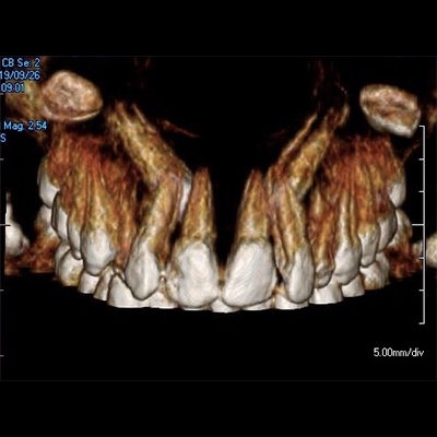 X-ray of complex dental case