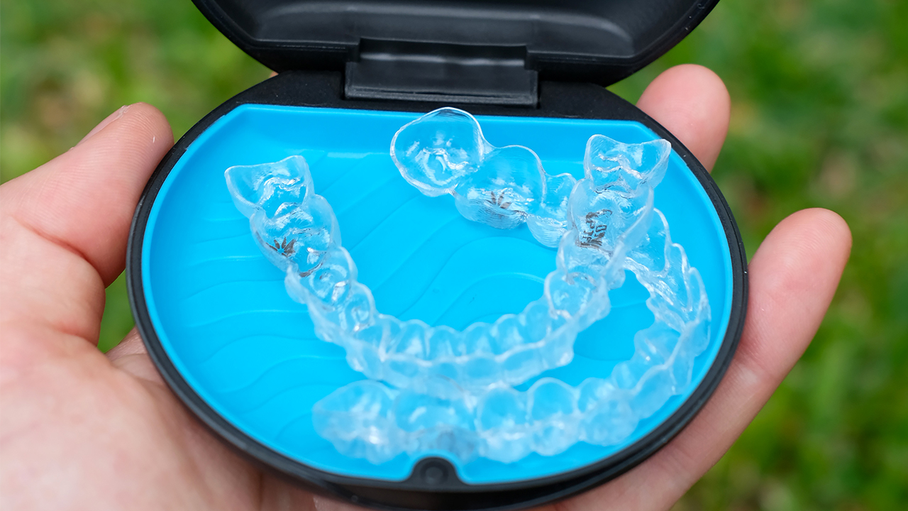 Upper and lower Invisalign aligners